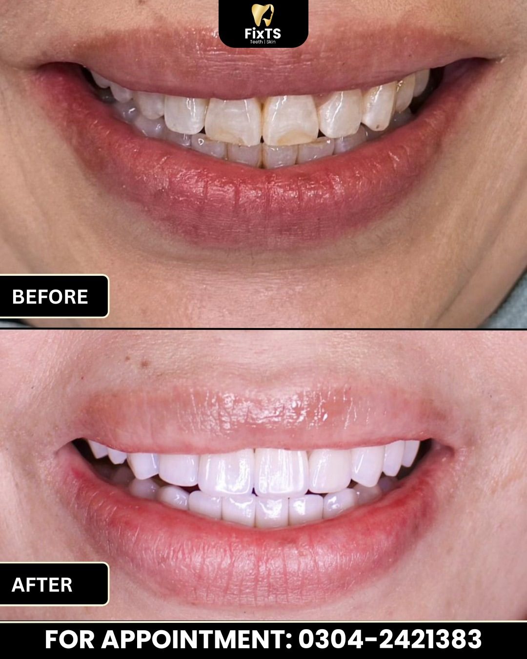 A Brighter, Healthier Smile