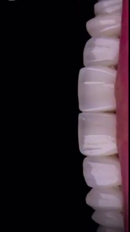 A Smile Makeover