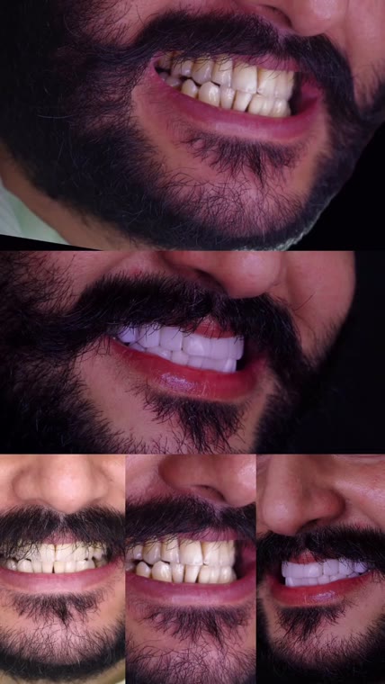 One Radiant Grin