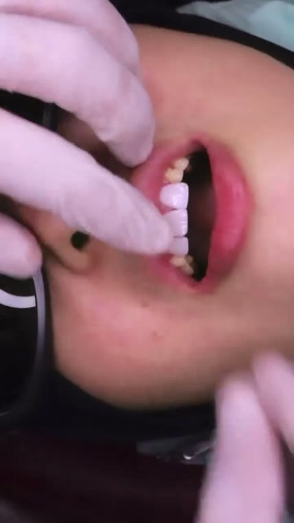 Unlock Your Smile