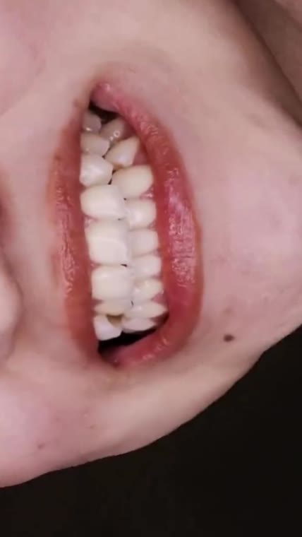 A Hollywood Smile